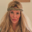 RHOBH: Brandi Glanville Says Her Facial Health Crisis Has Returned After Years of Searching for Answers