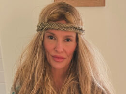 RHOBH: Brandi Glanville Says Her Facial Health Crisis Has Returned After Years of Searching for Answers