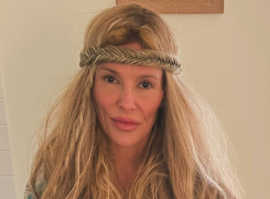 RHOBH: Brandi Glanville Says Her Facial Health Crisis Has Returned After Years of Searching for Answers