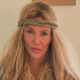 RHOBH: Brandi Glanville Says Her Facial Health Crisis Has Returned After Years of Searching for Answers
